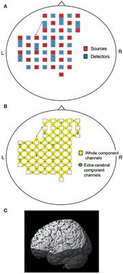 Cerebral Hemodynamics in Speech-Related Cortical Areas: Articulation Learning Involves the Inferior Frontal Gyrus, Ventral Sensory-Motor Cortex, and Parietal-Temporal Sylvian Area